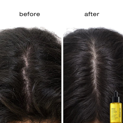 Concentré d'huile nourrissante pour cuir chevelu et cheveux Essence Absolue 50 ml - Shu Uemura